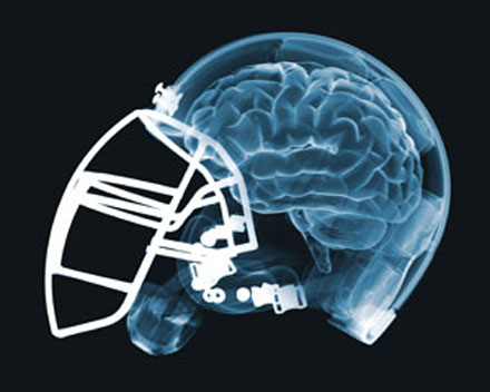 Concussion awareness hits home with NFL - and me