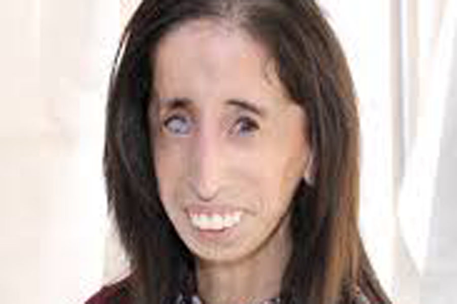 Reactions: Lizzie Velasquez's story